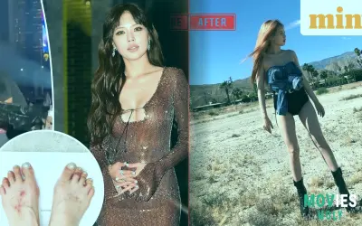 K-pop Star HyunA's On-Stage Collapse Sparks Urgent Health Debates